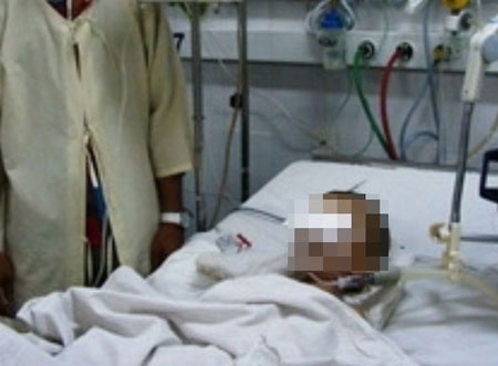 Sau khi bị người giữ trẻ đánh vào vùng vai dưới cổ, bé gái 2 tuổi ngất xỉu rồi tử vong