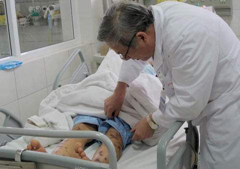 Bệnh não mô cầu cướp tính mạng trong vòng 24h xuất hiện tại Hà Nội