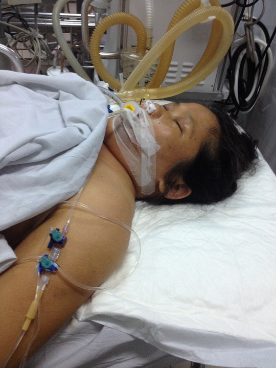 Bệnh nhân mổ gãy chân tử vong ở Đà Nẵng: GĐ Sở Y tế kết luận