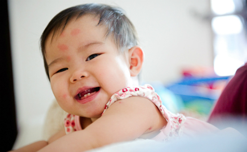 Chọn kem chống muỗi phòng sốt xuất huyết cho bé
