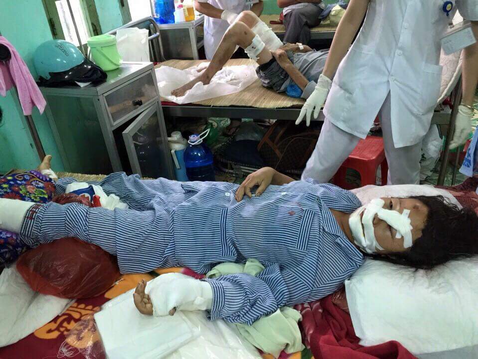 Nạn nhân Nguyễn Thị Hồng tại Bệnh viện Đa khoa Bắc Giang
