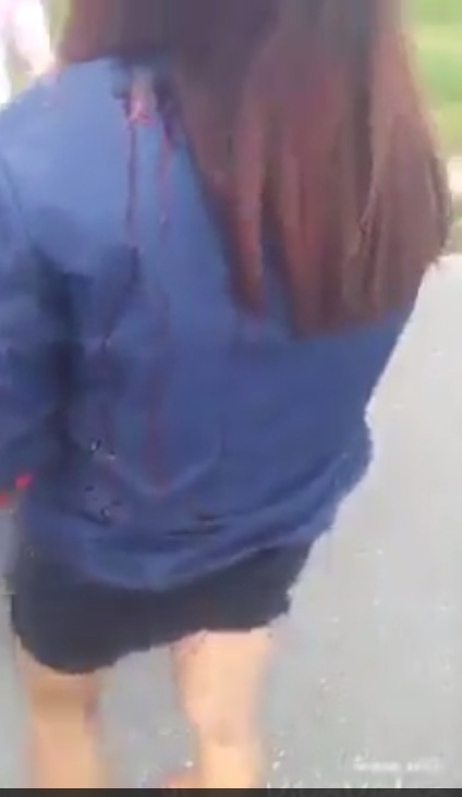 Video nữ sinh bị đánh hội đồng cho thấy nạn nhân chảy rất nhiều máu sau khi bị gậy sắt quật vào đầuVideo nữ sinh bị đánh hội đồng cho thấy nạn nhân chảy rất nhiều máu sau khi bị gậy sắt quật vào đầu