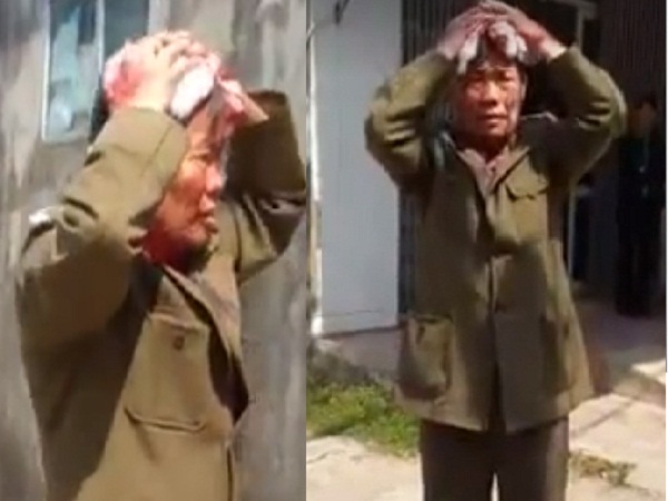 Ông bố chồng bị chảy rất nhiều máu 