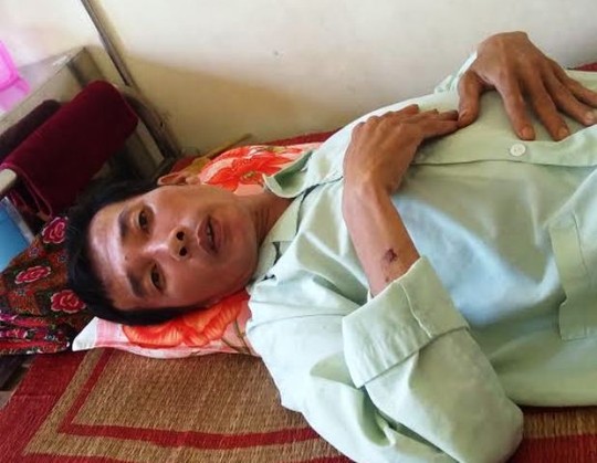 Vụ việc công an đánh dân gãy xương sườn đang gây xôn xao dư luận xã Duy Hải, huyện Duy Tiên, tỉnh Hà Nam