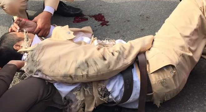 Đồng chí CSGT bị kéo lê trên đường dẫn tới chảy máu, bị chấn thương, quần áo rách bươm