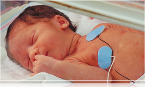 Trẻ sơ sinh bị Đảo gốc động mạch - là một dị tật tim bẩm sinh hiếm gặp mà thông thường tới 99% sẽ tử vong. ẢNh minh họa  