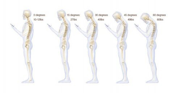 Áp lực trên cổ của bạn trở nên mạnh hơn khi cúi đầu dùng điện thoại. (Mô hình minh họa của Hansraj)