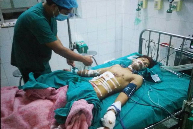 Bệnh nhân Tiến đang điều trị tại khoa Phẫu thuật - Gây mê hồi sức (BV Tuyên Quang) sau vụ nổ đèn pin Trung Quốc