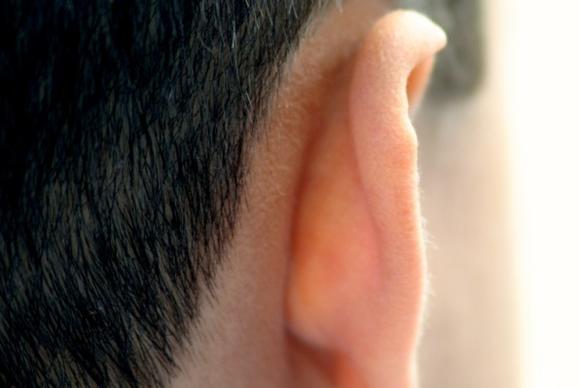 Đằng sau tai là vị trí rất dễ phát ung thư da