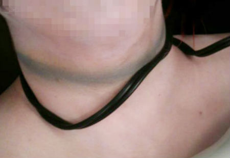 Thiếu niên 15 tuổi đã bị gia đình dùng sợi dây siết cổ dẫn đến tử vong