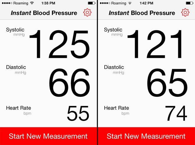 Ứng dụng y tế trên di động vào đo nhịp tim cho kết quả không chính xác