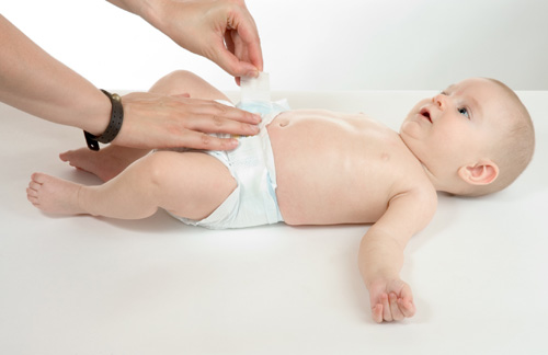 Việc đóng bỉm, tã giấy cho bé quá thường xuyên có thể gây ra tình trạng hăm bí, nhiễm trùng