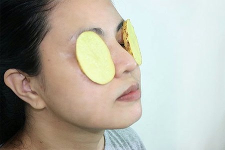 Cách chăm sóc da, giảm quầng thâm mắt hữu hiệu nhờ khoai tây