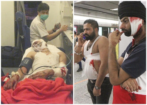 Người bị thương tại ga tàu Hong Kong, theo những tin tức mới cập nhật 24h hôm nay
