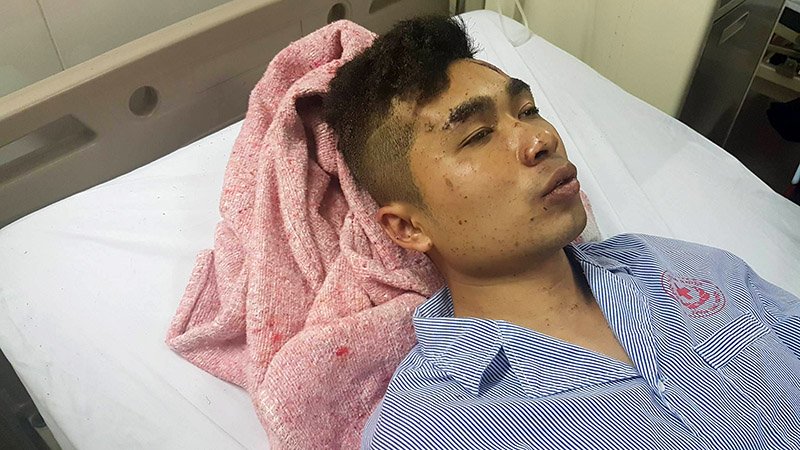  Anh Nông Đức Thương vẫn đang được điều trị tại BV Đa khoa Bắc Ninh sau vụ nổ xe khách ở Bắc Ninh. Ảnh: Vietnamnet