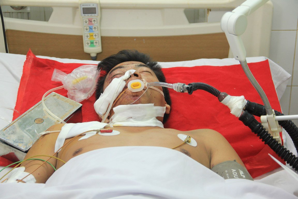 Tài xế Võ Ngọc Quý đang cấp cứu tại bệnh viện trong tình trạng hôn mê sâu. Ảnh: VietNamNet 