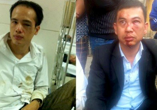 2 luật sư sau khi bị hành hung ở Chương Mỹ, Hà Nội. 