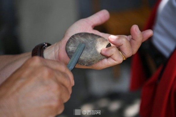 Rợn người xem làm sạch tròng mắt bằng dao cạo của người Trung Quốc
