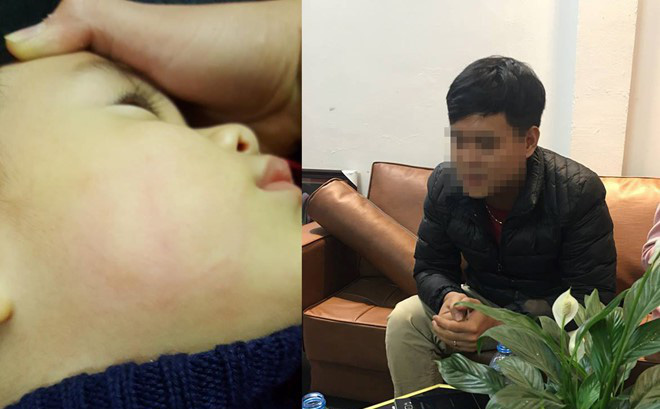 Bé trai 22 tháng tuổi bị bác sĩ tát đỏ mặt: Bộ Y tế yêu cầu kiểm tra và xử lý nghiêm khắc