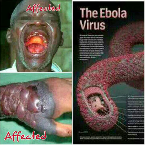 Cảnh giác với virus Ebola