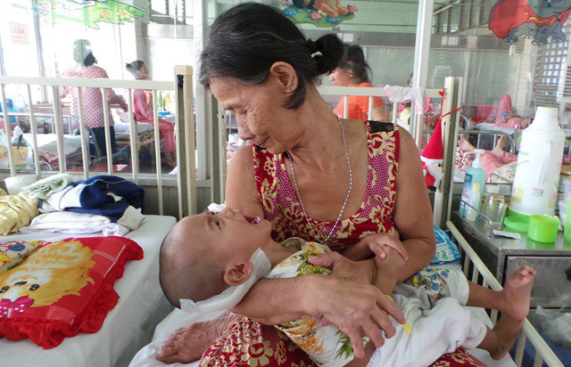 Việt Nam đứng thứ 16 trên thế giới vì số người chết vì bệnh lao