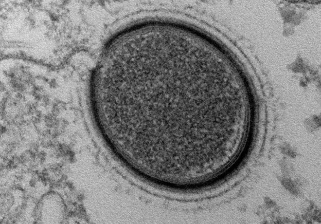 Đây là chủng virus cổ đại thứ tư được tìm thấy từ năm 2003
