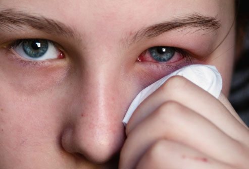 Khăn mặt kém chất lượng có thể gây viêm mắt, dị ứng