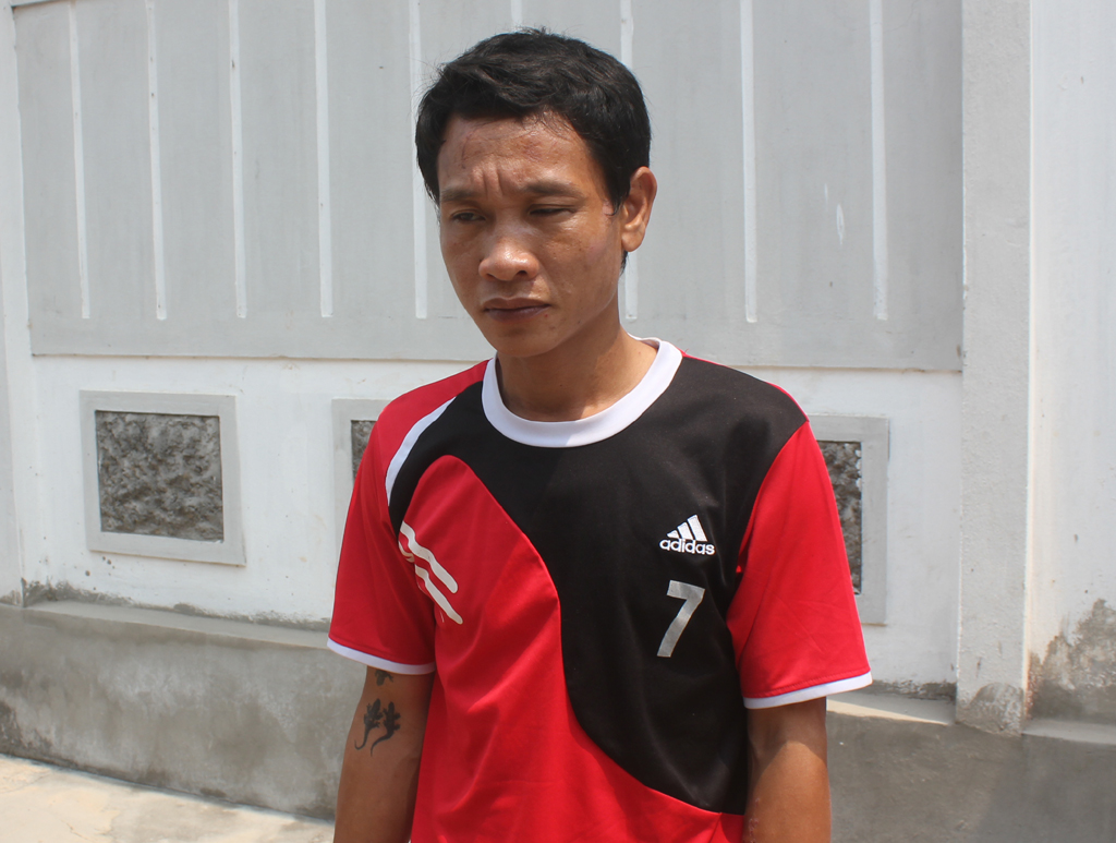 Chu Văn Sơn từng có 5 tiền án và hiện bị nhiễm HIV