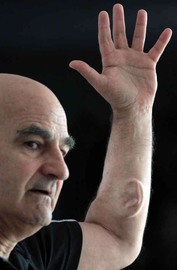 Người nghệ sĩ 69 tuổi đã cấy tai vào cánh tay và lên kế hoạch kết nối wifi cho nó