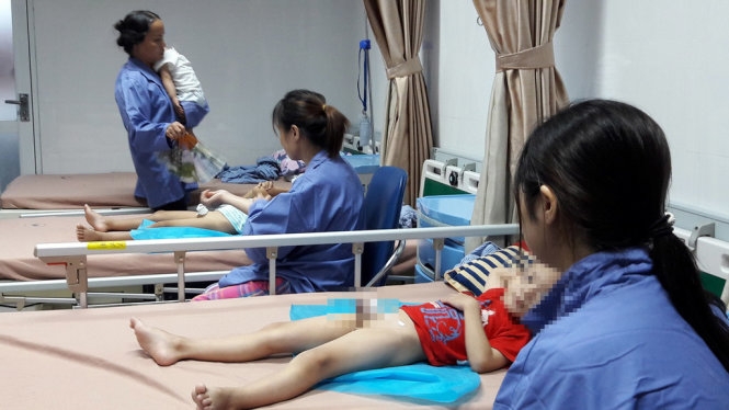 Bệnh viện Da liễu Trung ương sẽ miền phí điều trị cho các trẻ em bị sùi mào gà ở huyện Khoái Châu