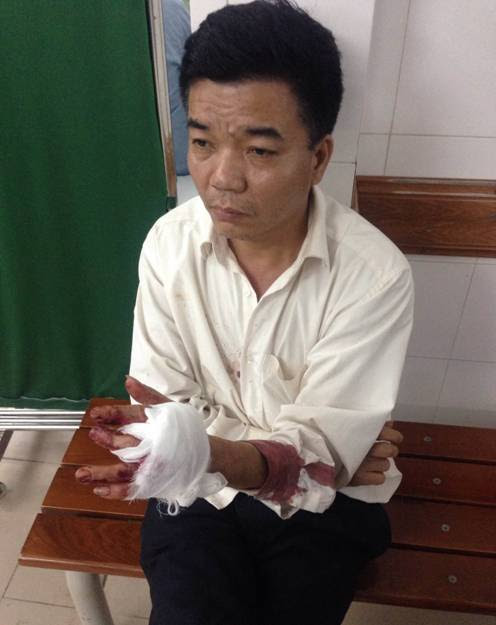 Bảo vệ Nguyễn Đoàn Bộ bị chém đứt gân tay