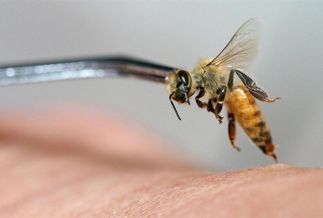 Bé trai 19 tháng tuổi nguy kịch, nhập viện với gần 1.000 vết ong đốt