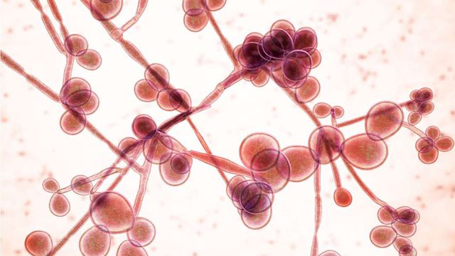 Vi khuẩn nấm siêu mạnh: ‘Giết’ hơn nửa số bệnh nhân bị nhiễm trong vòng 90 ngày 