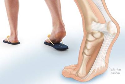Dép tông dễ gây tổn thương do ngón chân. 