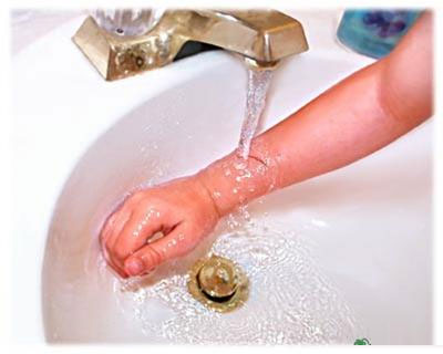 Nếu trẻ bị bỏng bạn nên Làm mát vết bỏng, tránh cho da khỏi bị rộp bằng cách mở vòi nước cho chảy chầm chậm.