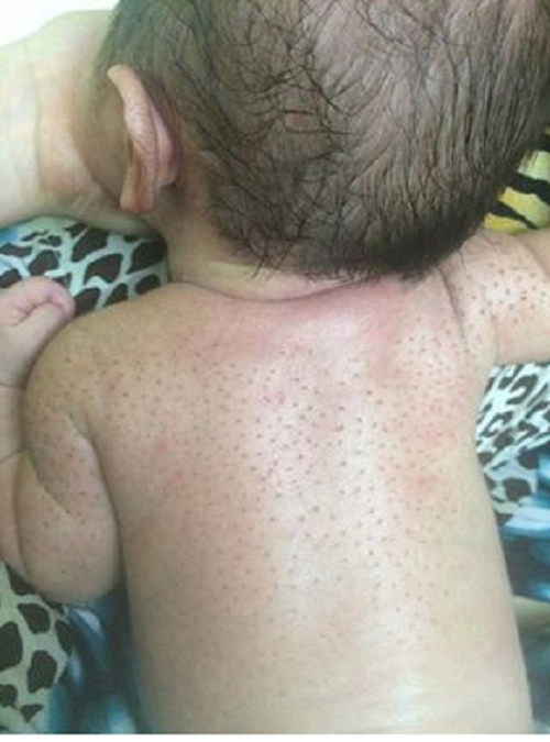  Hình ảnh một bé sơ sinh đã được cạo lông tơ được chia sẻ trên mạng xã hội. 
