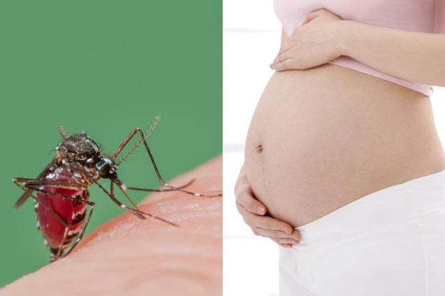 Thai phụ mắc bệnh Zika dù nhẹ cũng khiến thai nhi dị tật. Ảnh minh họa 
