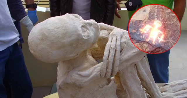  Xác ươp ở Peru chỉ có 3 ngón tay nghi là người ngoài hành tinh. Ảnh: Tuổi trẻ