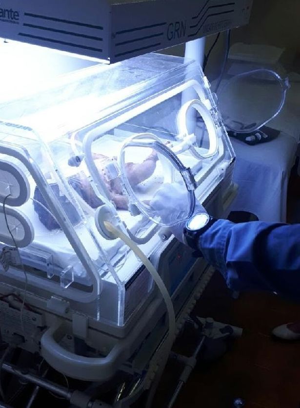 Bé gái sơ sinh được chăm sóc đặc biệt tại bệnh viện sau khi được cứu sống thần kỳ. Video: Amazing