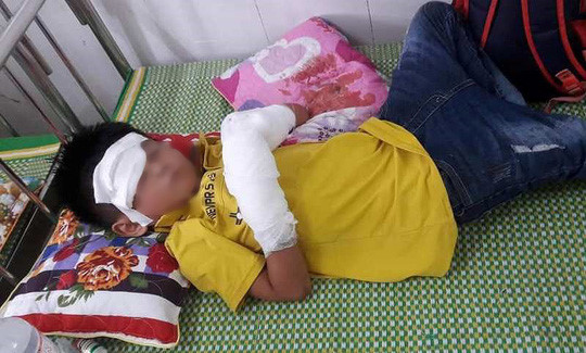 Cậu bé đã phải nhập viện trong tình trạng nát hai cánh tay do dùng điện thoại khi đang sạc bị nổ. ẢNh: PL TPHCM