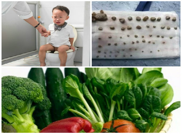 Trẻ không ăn rau xanh ngoài bị sỏi thận còn hàng loạt bệnh nguy hiểm  