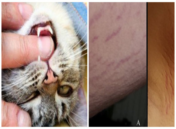  Mèo cào rất nguy hiểm vì có thể gây bệnh dại, mù lòa, thần kinh