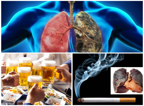 Ung thư phổi vô cùng nguy hiểm vì gây tử vong cao  