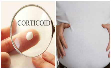 Do sử dụng thuốc chứa corticoid người đàn ông đã phải nhập viện do trướng bụng, xơ gan  
