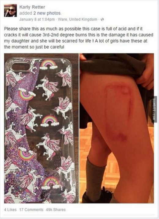 Người dùng Facebook Karly Retter đăng tải hình ảnh và chia sẻ về vết bỏng do ốp điện thoại gây ra