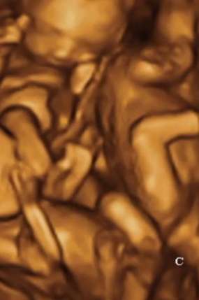 Hình ảnh siêu âm thai nhi được cô gái dùng để lừa mọi người 