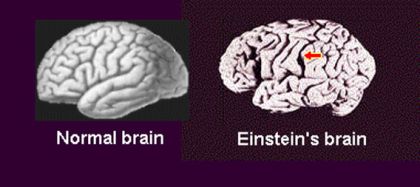 Bộ não của nhà bác học Albert Einstein