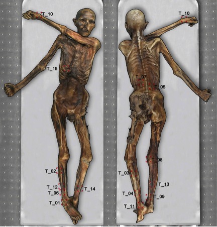 Bản đồ thể hiện vị trí của 19 cụm hình xăm trên xác ướp người băng Otzi