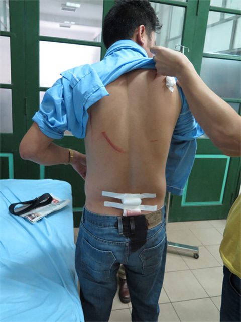 Sau vụ việc nhà báo bị tấn công gây xôn xao, ông Nguyễn Ng. Q. nhập viện với 8 vết chém trên người