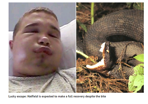 Rất may là Hatfield có thể hồi phục sau vết cắn của con rắn hổ mang nước